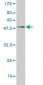 CXCL16 Antibody (monoclonal) (M05)